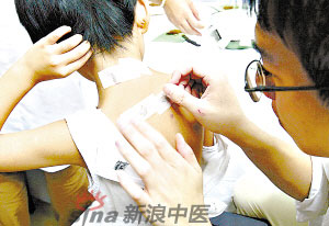 灸法的種類  你知道多少？